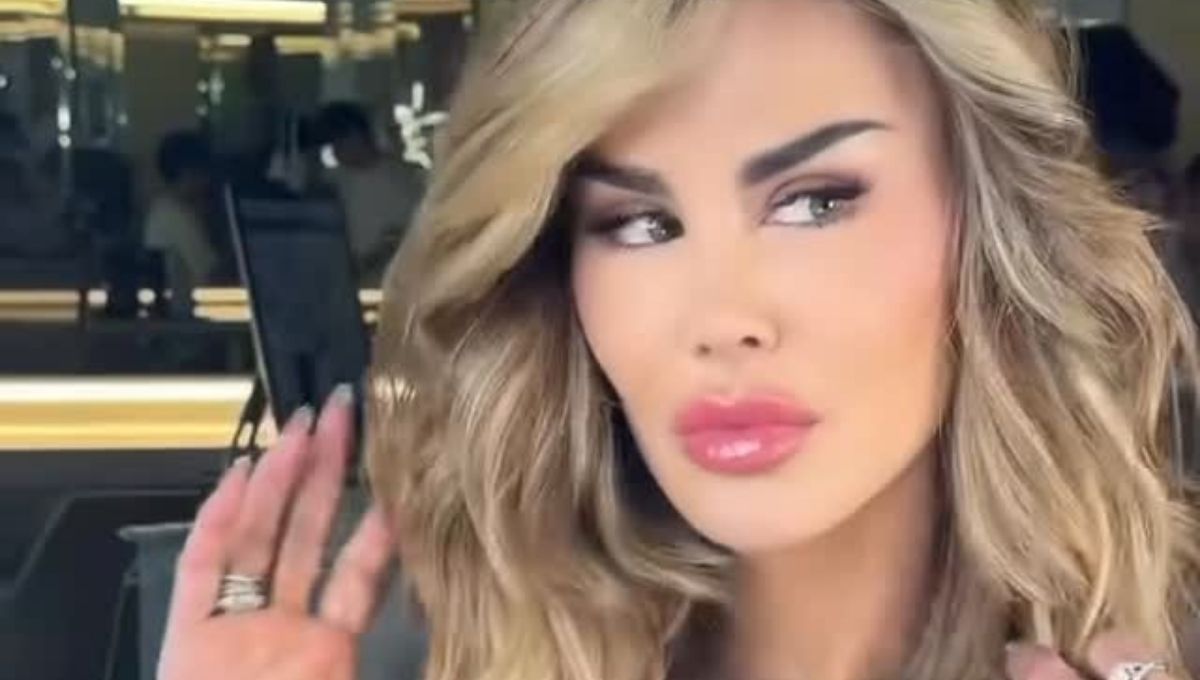 El “bombón asesino” y su nueva mirada: La cirugía sin dolor de Ninel Conde