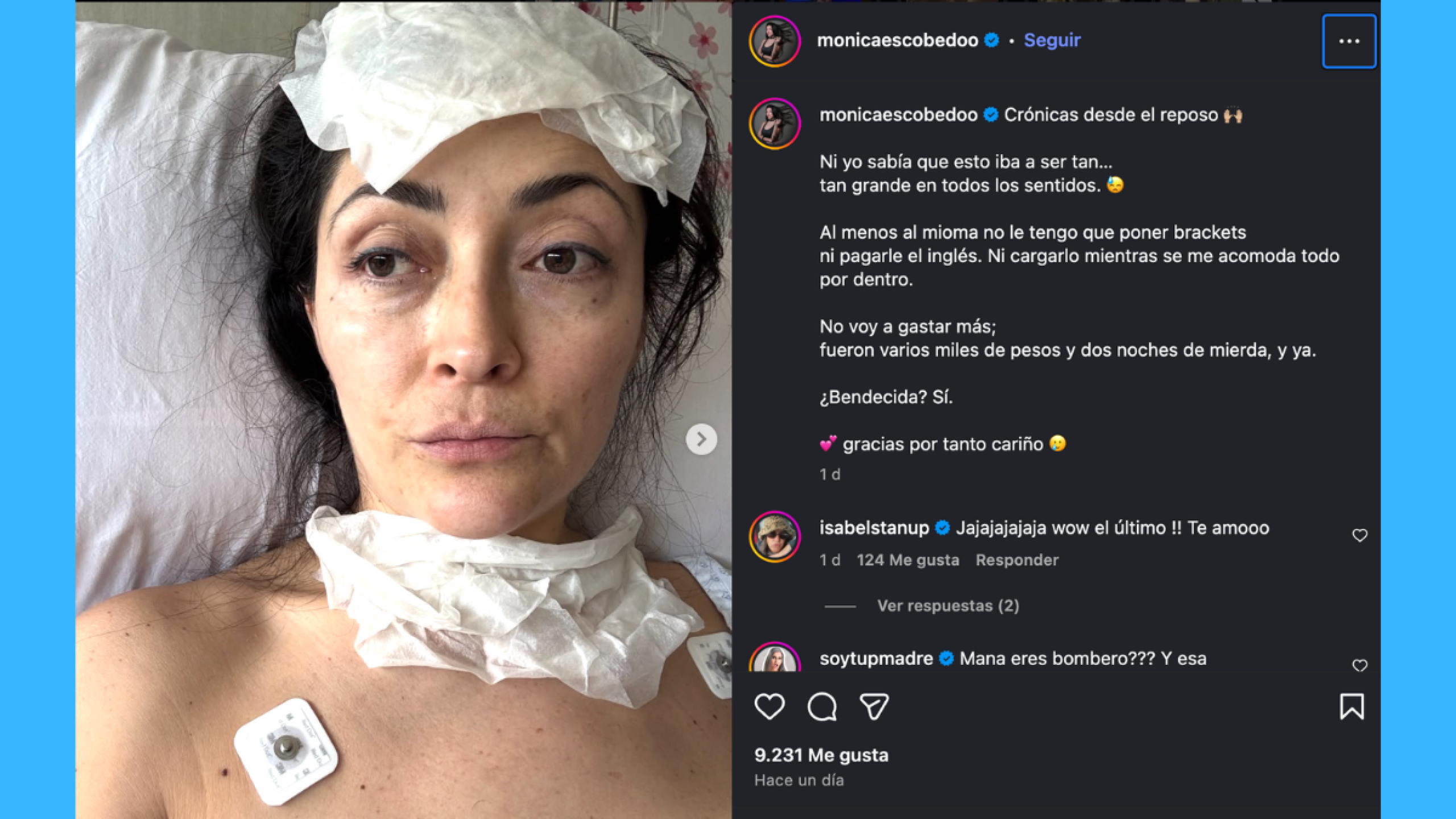 El complejo momento de Mónica Escobedo: fue hospitalizada para retirarle un mioma