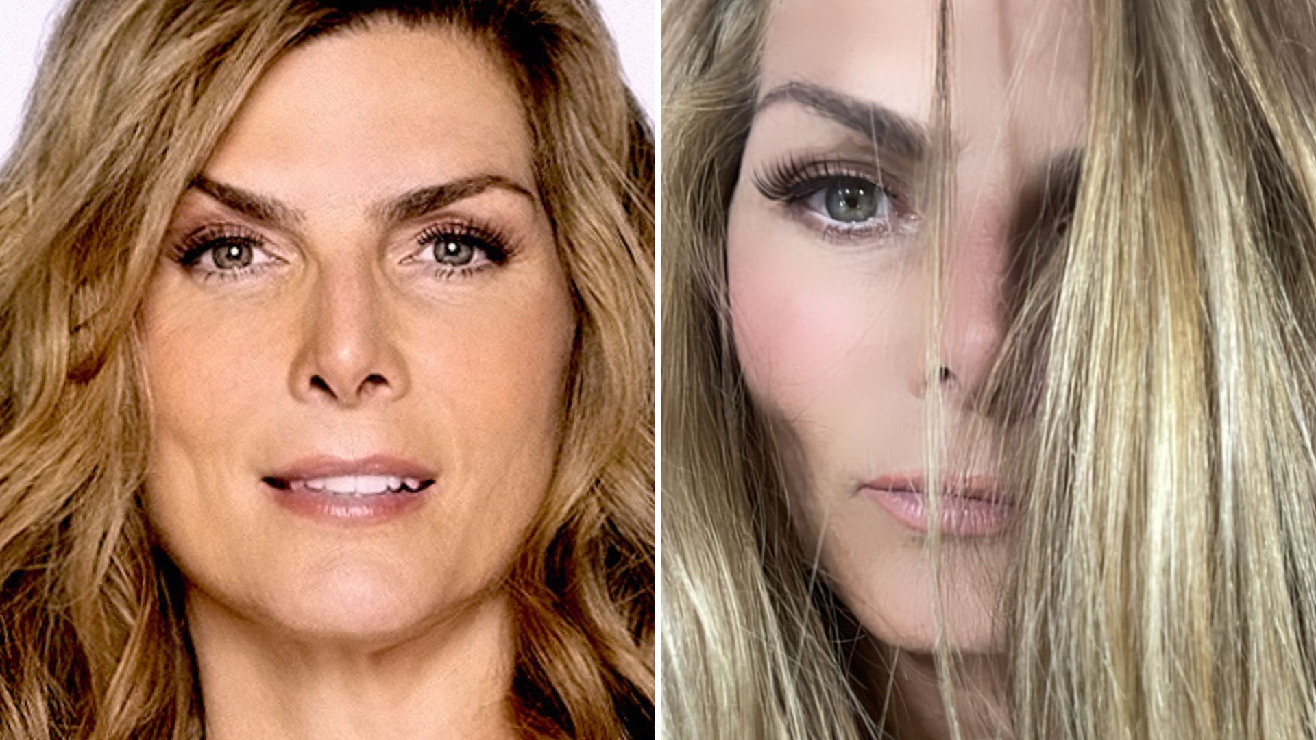 Montserrat Oliver revela secuela visual tras infarto óptico