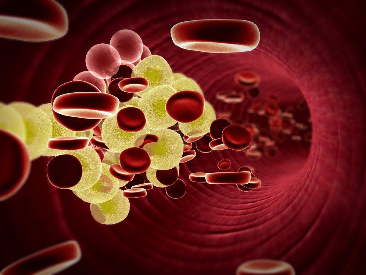 Grasas saturadas y diabetes: lo que nadie te contó sobre su verdadero impacto