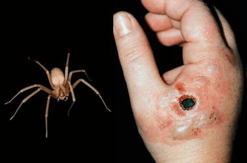 Araña violinista mata a joven en Sonora: ¿puede pasarte a ti también?