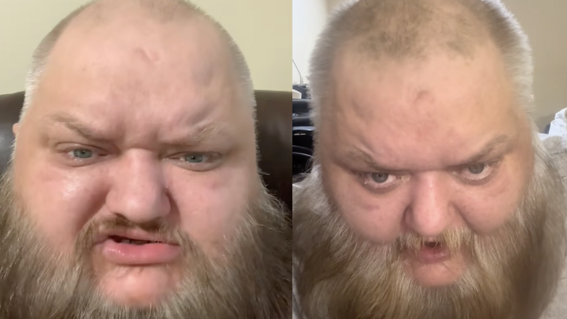 Muere el influencer John Crawley por paro cardíaco: El viral ‘KingBeardX’